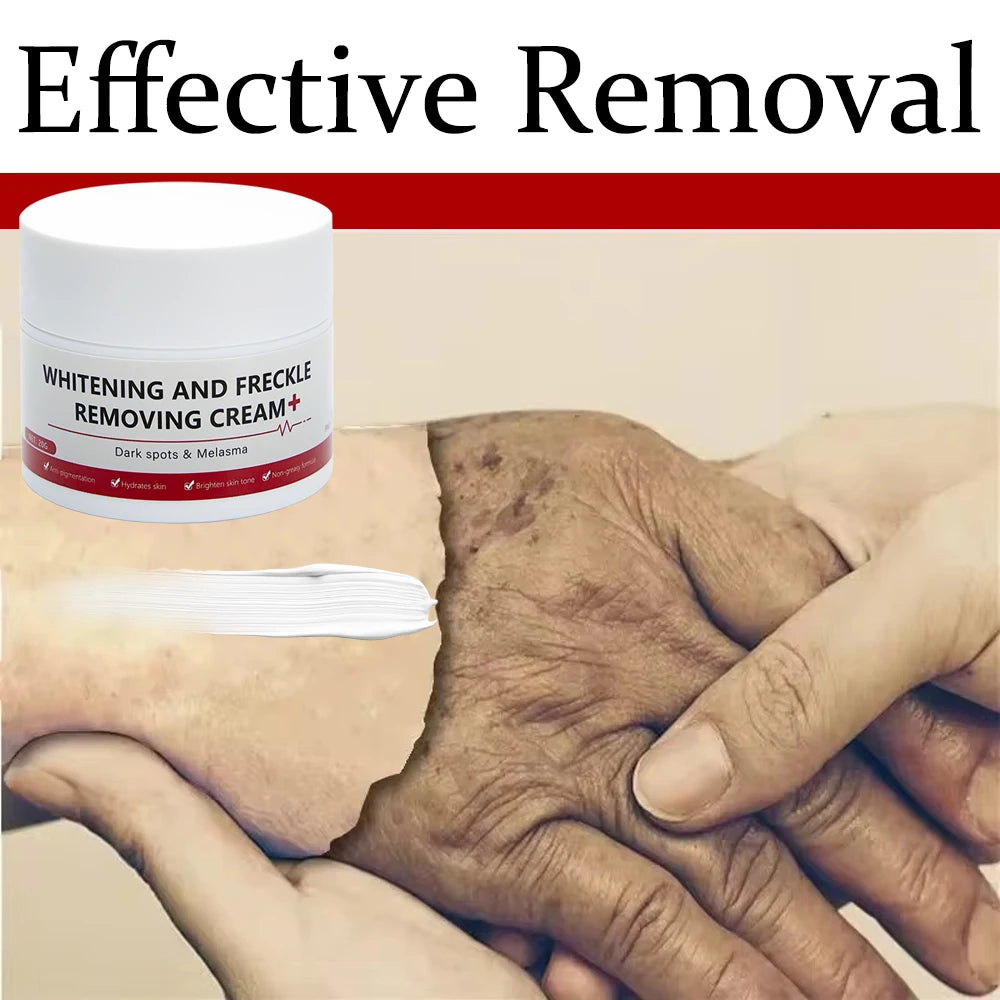 Play Video Powerful Spot-removing Whiten Cream Brighten Skin Fast Eliminates Melanin Pigmentation Melasma Dark Spots Korean Sk