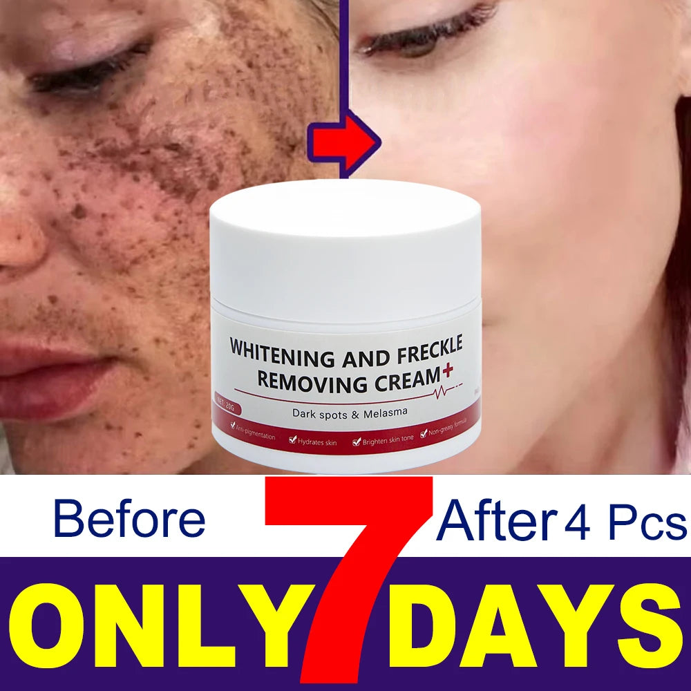 Play Video Powerful Spot-removing Whiten Cream Brighten Skin Fast Eliminates Melanin Pigmentation Melasma Dark Spots Korean Sk